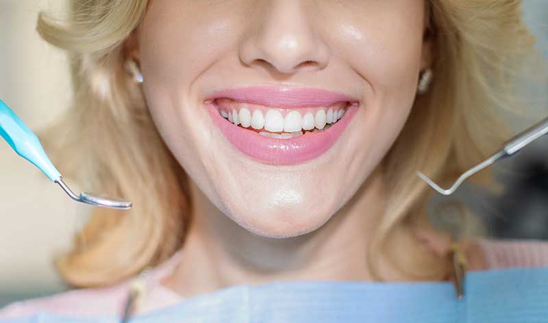 mejores formas de blanquear los dientes