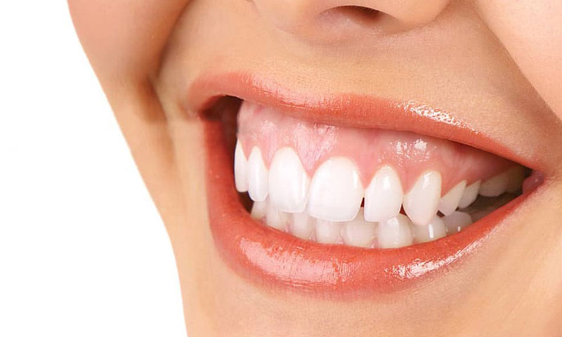 sonrisa gingival y cómo tratarla